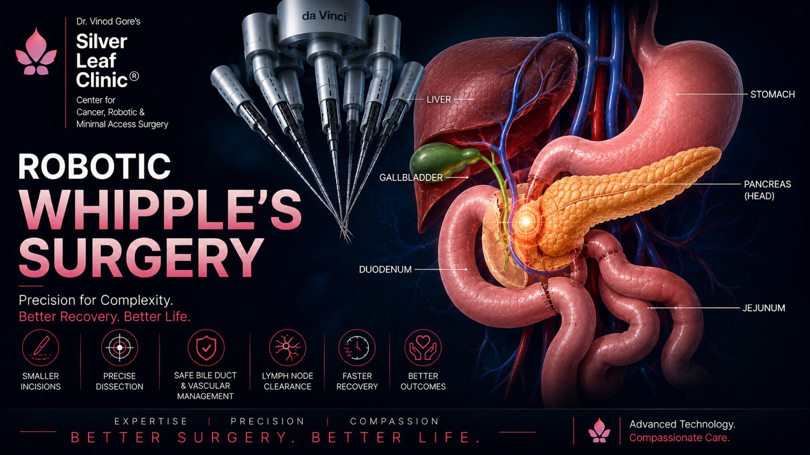 Robotic Whipple Surgery